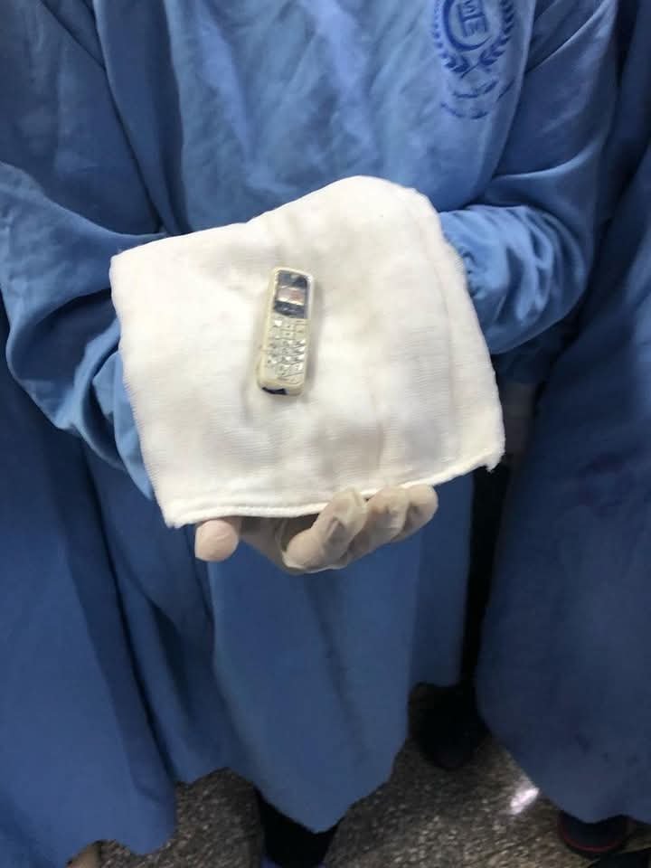 غرائب داخل بطون المرضى.. أموال وأدوات مطبخ وبرص ومنشار كهربائي 4