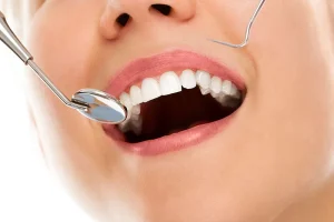 ابتسامة هوليوود