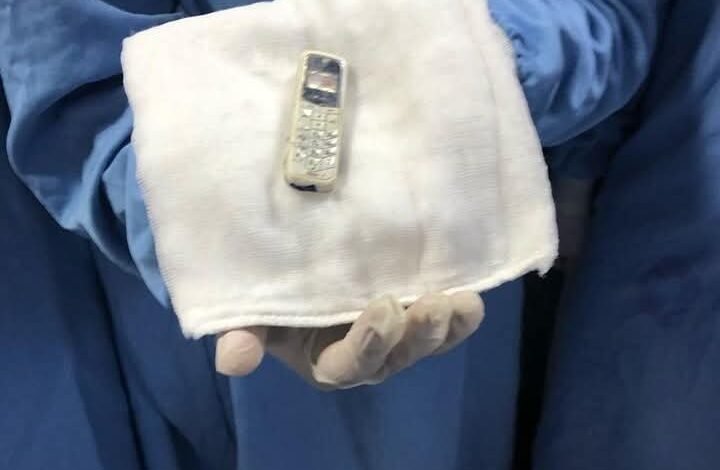 غرائب داخل بطون المرضى.. أموال وأدوات مطبخ وبرص ومنشار كهربائي 1