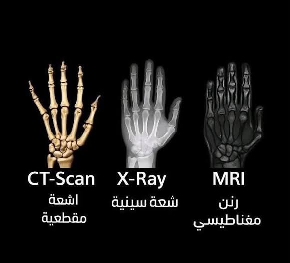 بين X-Ray وCT وMRI.. أيهم تختار؟ دليلك لفهم أنواع الأشعة الطبية واستخداماتها 1