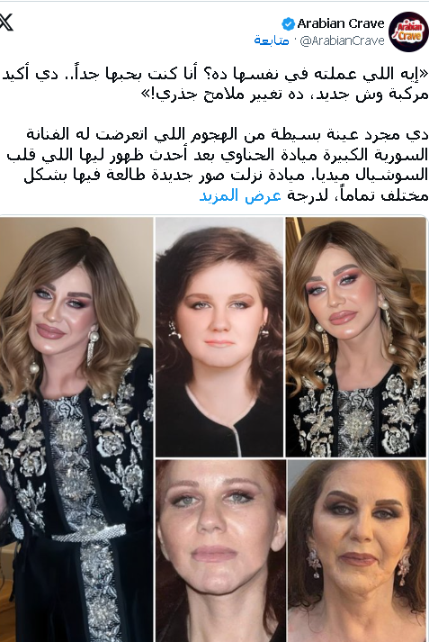 ميادة الحناوي تثير الجدل بإطلالة شبابية وتتصدر الترند بعد حفل ضخم بالمغرب 2