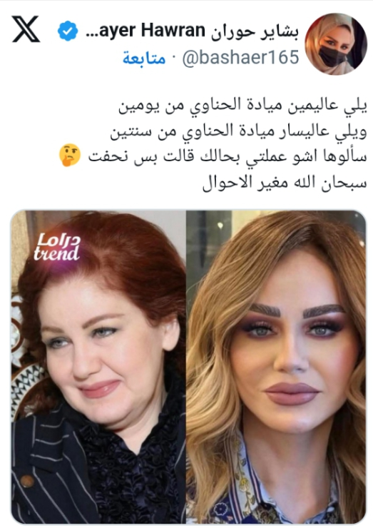 ميادة الحناوي تثير الجدل بإطلالة شبابية وتتصدر الترند بعد حفل ضخم بالمغرب 3