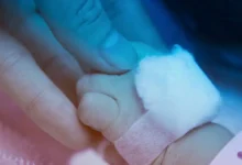 إصابة طفل بشلل أثناء تركيب كانيولا داخل مستشفى بالقليوبية