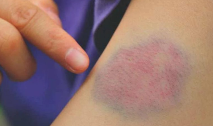 دراسة حديثة تكشف: الصيام يحسن تخثر الدم ويحمي القلب والدماغ 1