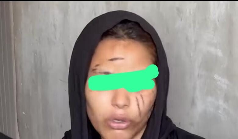 حبس وضرب وجروح متفرقة.. كواليس مأساوية وراء بلاغ زوجة ضد زوجها بشبرا 1